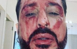 FABRIZIO CORONA NUOVAMENTE NEL MIRINO