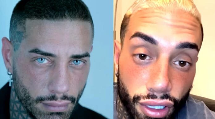 FRANCESCO CHIOFALO E LA MODIFICA DEGLI OCCHI